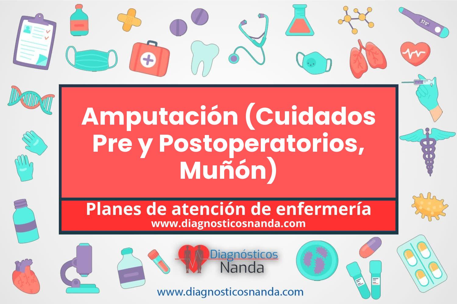 Plan de atención de enfermería Amputación (Cuidados Pre y Postoperatorios, Muñón)