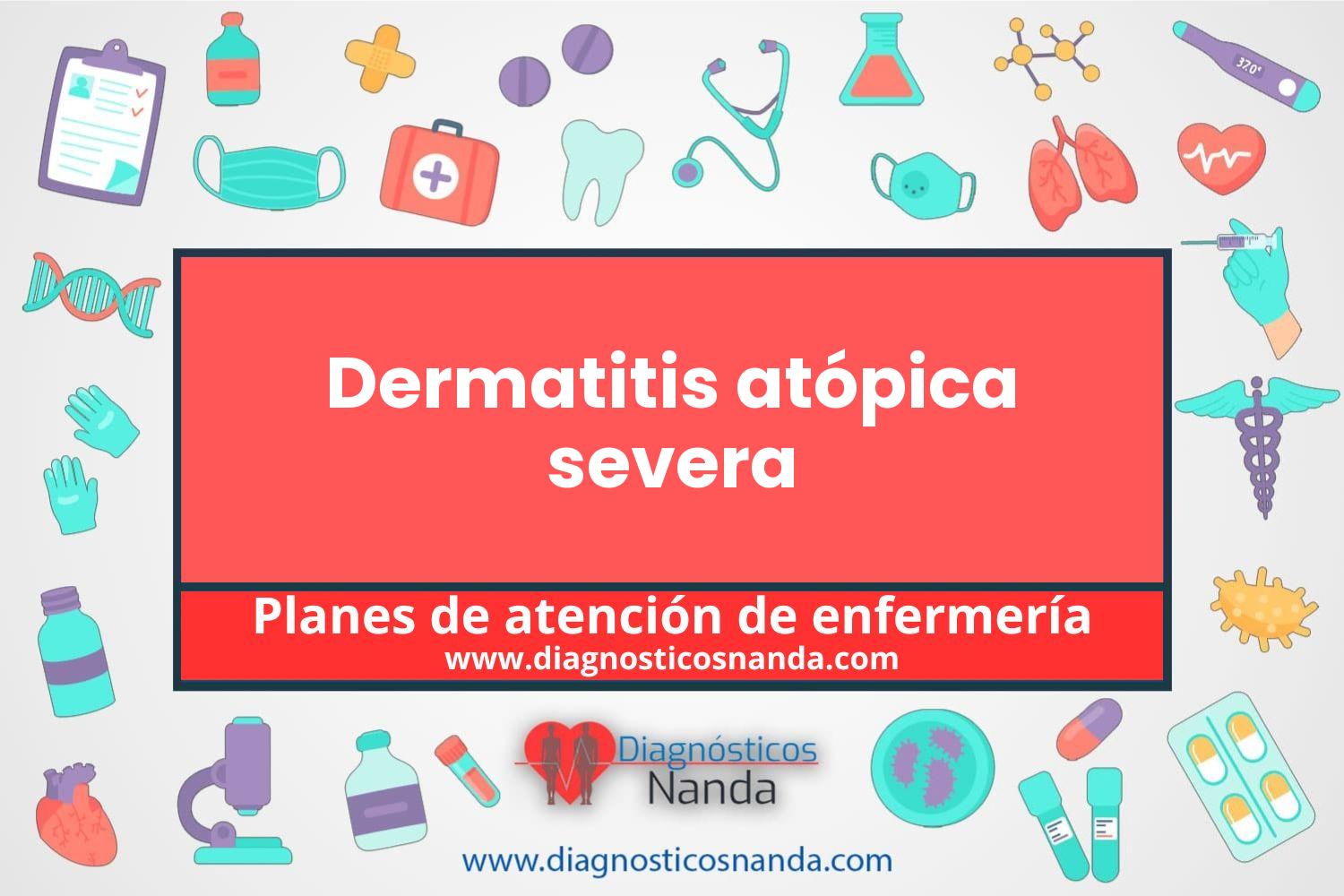Plan de atención de enfermería Dermatitis atópica severa
