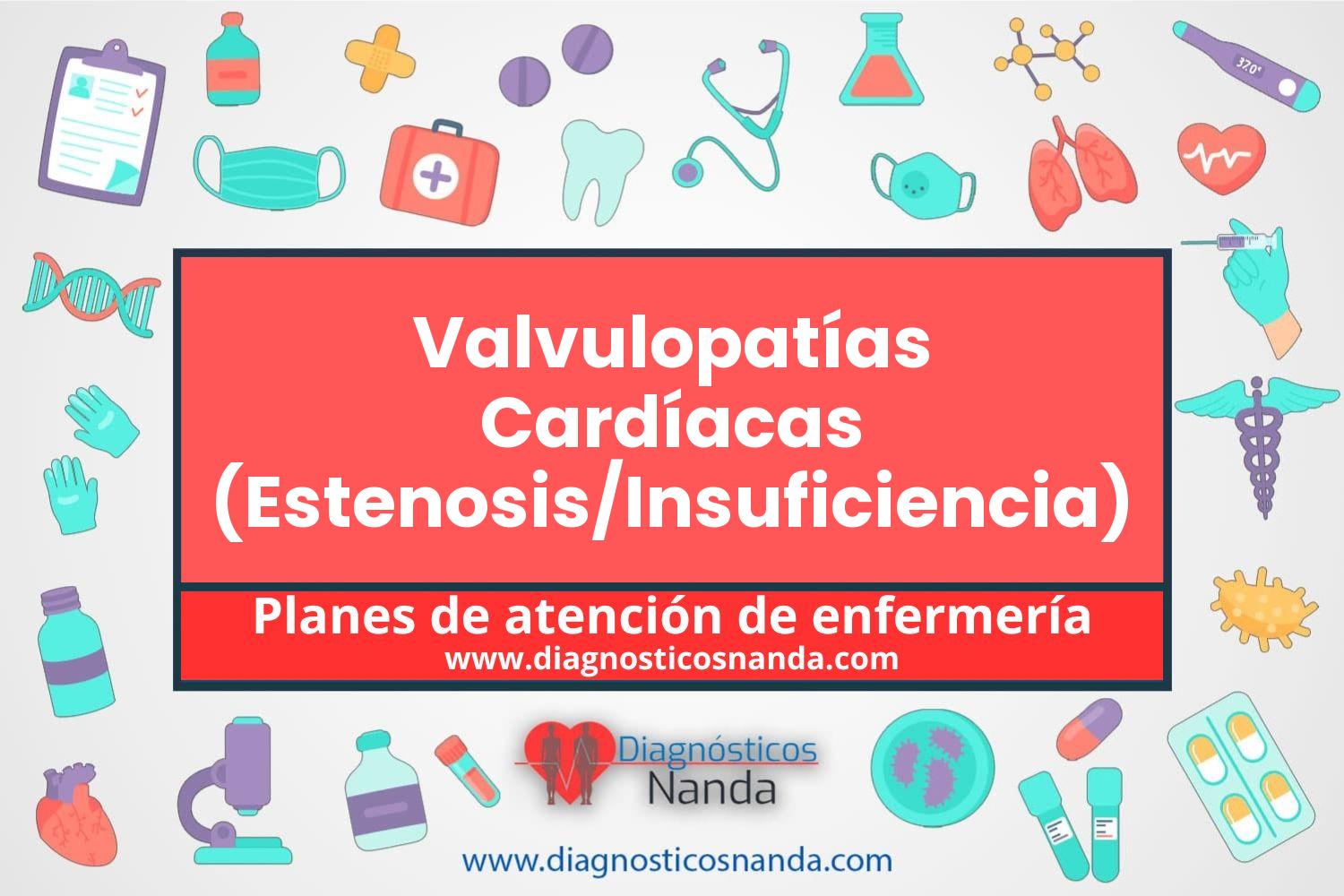 Plan de atención de enfermería Valvulopatías Cardíacas (Estenosis/Insuficiencia)